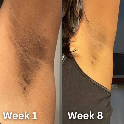 𝙋𝙪𝙧𝙤𝙫𝙚𝙙® Skin Brightening Deodorant - Limited Offer