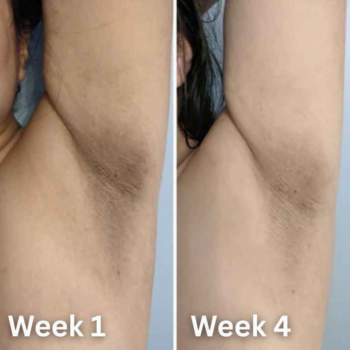 𝙋𝙪𝙧𝙤𝙫𝙚𝙙® Skin Brightening Deodorant - Limited Offer