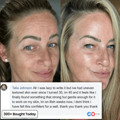 𝙋𝙪𝙧𝙤𝙫𝙚𝙙® PDRN Pink Collagen Volume Multi Balm