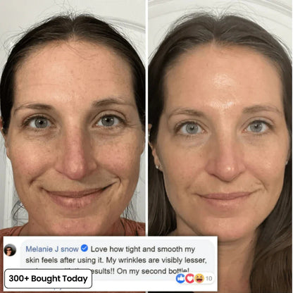 𝙋𝙪𝙧𝙤𝙫𝙚𝙙® PDRN Pink Collagen Volume Multi Balm