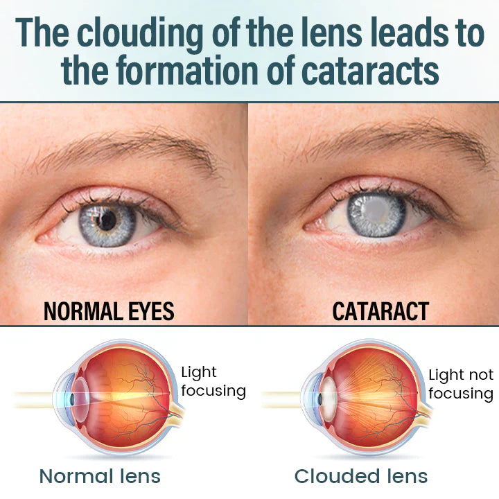 👩‍⚕️LOVILDS™ Nano Eye Drops Serum ✅FDA Approved(Suitable for presbyopia, dry eye syndrome, glaucoma, and cataracts) 👀