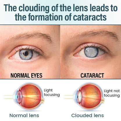 👩‍⚕️LOVILDS™ Nano Eye Drops Serum ✅FDA Approved(Suitable for presbyopia, dry eye syndrome, glaucoma, and cataracts) 👀