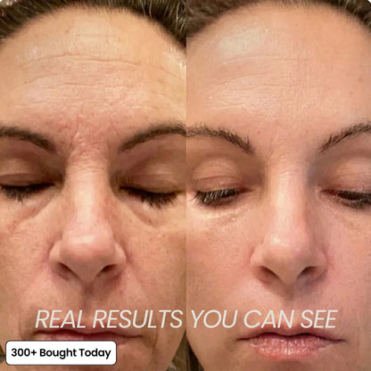 𝙋𝙪𝙧𝙤𝙫𝙚𝙙® PDRN Pink Collagen Volume Multi Balm