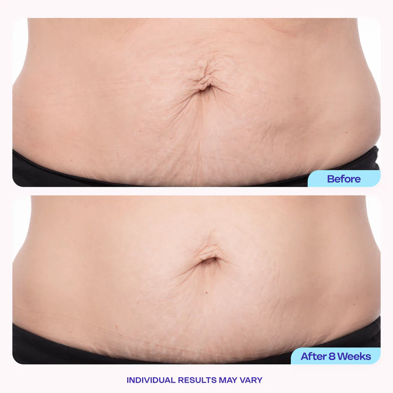 Care for changing belly skin with focused hydration.