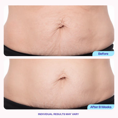 Care for changing belly skin with focused hydration.