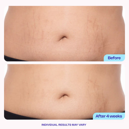 Care for changing belly skin with focused hydration.
