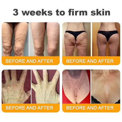 ✨FDA Approved:LOVILDS™  Bee Venom Skin Restoration Cream — 🔥Limited Time 70% OFF🔥